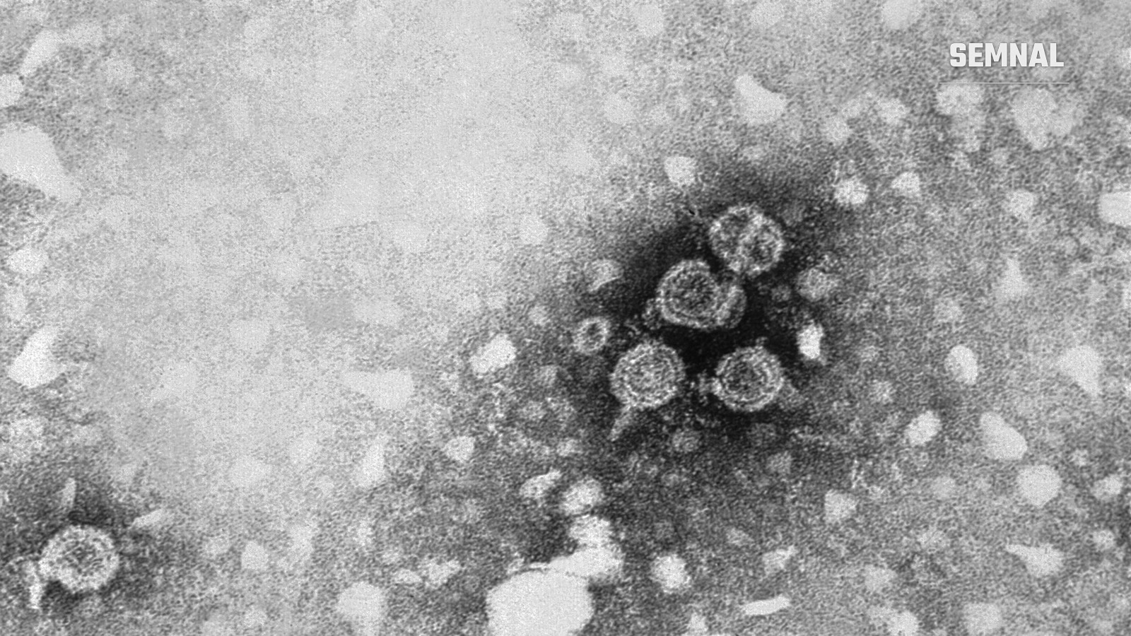 Micrografie electronică în alb-negru cu mai mulți virioni ai virusului hepatitic B, văzuți ca particule rotunde, granulate, pe un fundal cenușiu