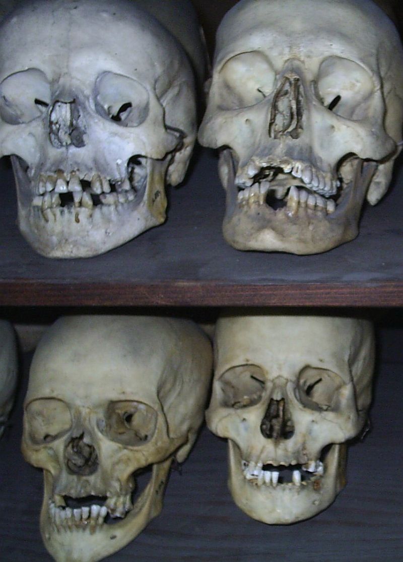 Blestemul craniilor sfărâmate